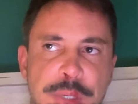 Reditelj Stevan Filipović pretučen u centru Beograda: Napadači mu oteli telefon, tukli ga metalnom stolicom, tvrdi da je u pitanju grupa plaćenika SNS (VIDEO)
